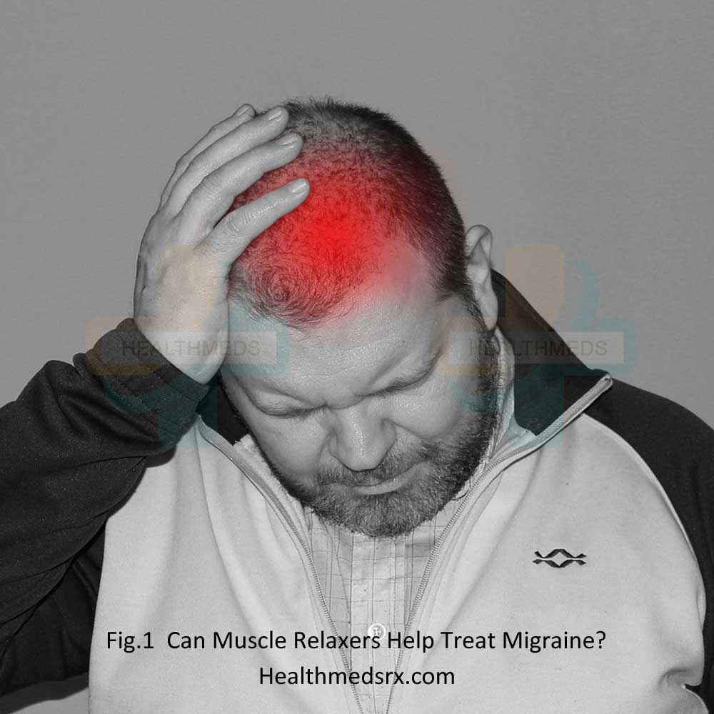 Treat Migraine with Muscle Relaxants-Healthmedsrx.com