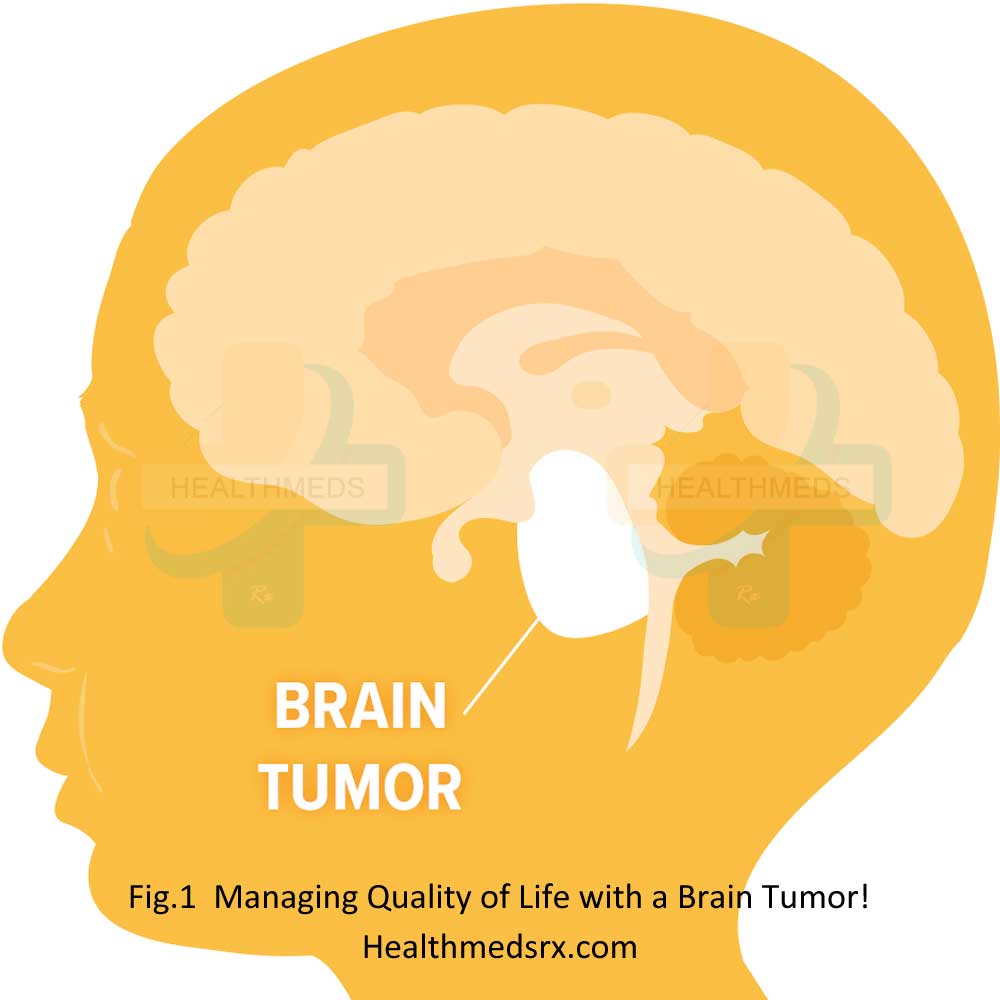 Living with Brain Tumor-Healthmedsrx.com