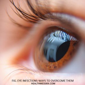 Treating Eye Infections
