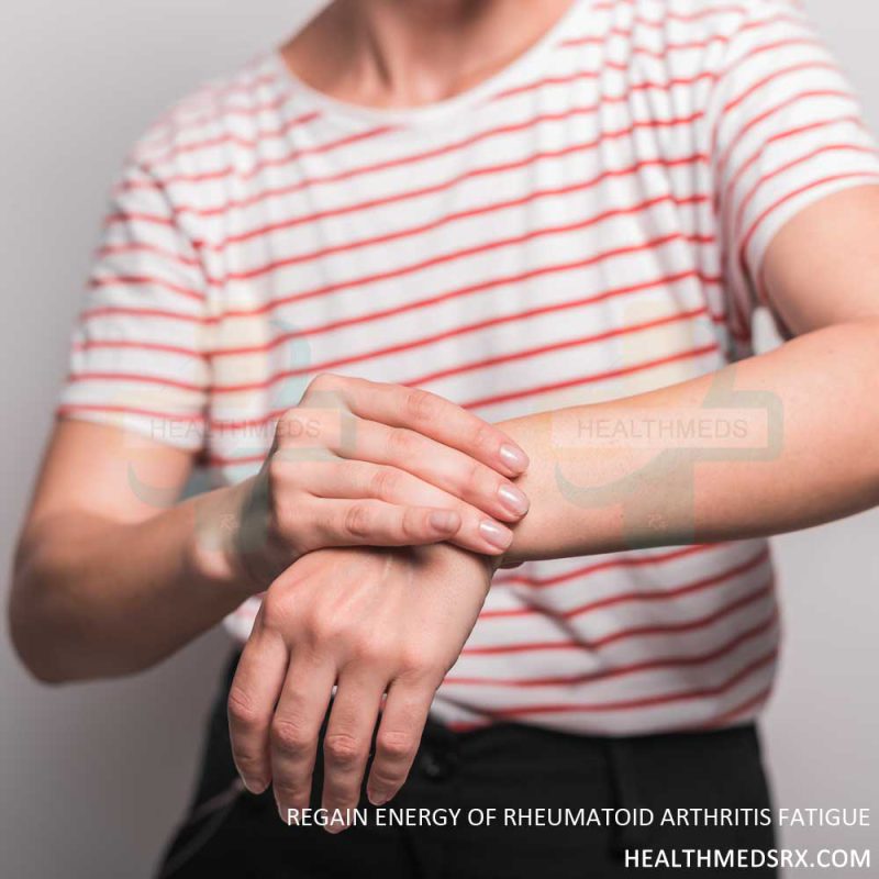 Rheumatoid Arthritis