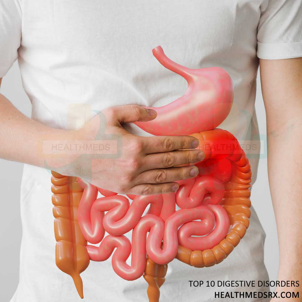 Top 10 Digestive Disorders
