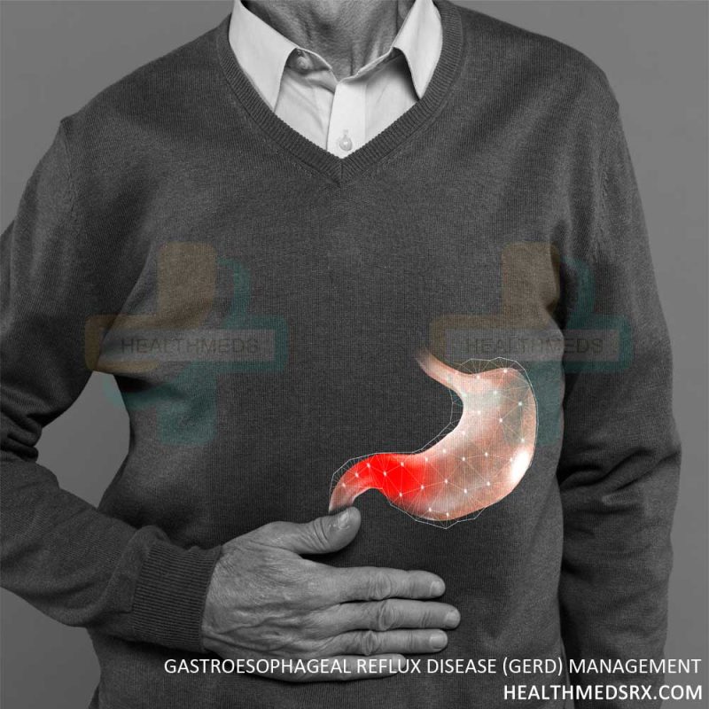 Gastroesophageal reflux disease (GERD) Management
