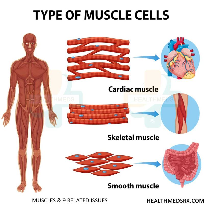 9 Muscles Related Issues