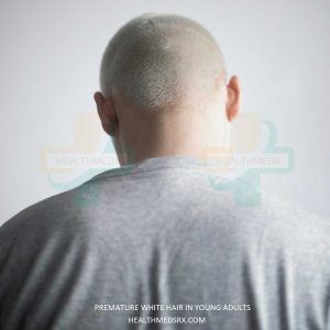 white hair young adult