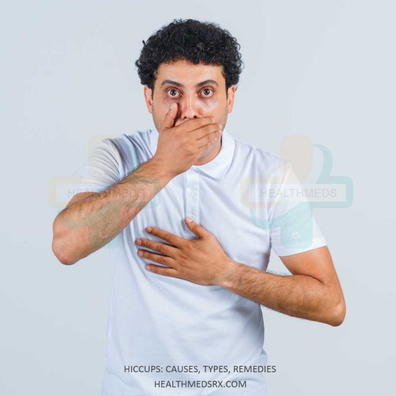 Hiccups Causes Types Remedies