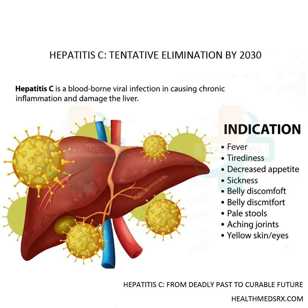 Hepatitis C Elimination by 2030
