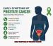 Early Symptoms of Prostate Cancer