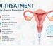 Intrauterine Insemination IUI