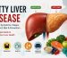 Fatty Liver